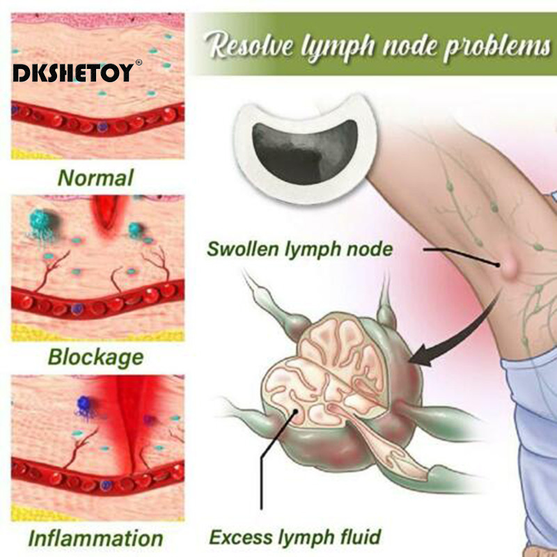 Afslanken Patch Lymfatische Ca - Herbal Weight recensie en prijs